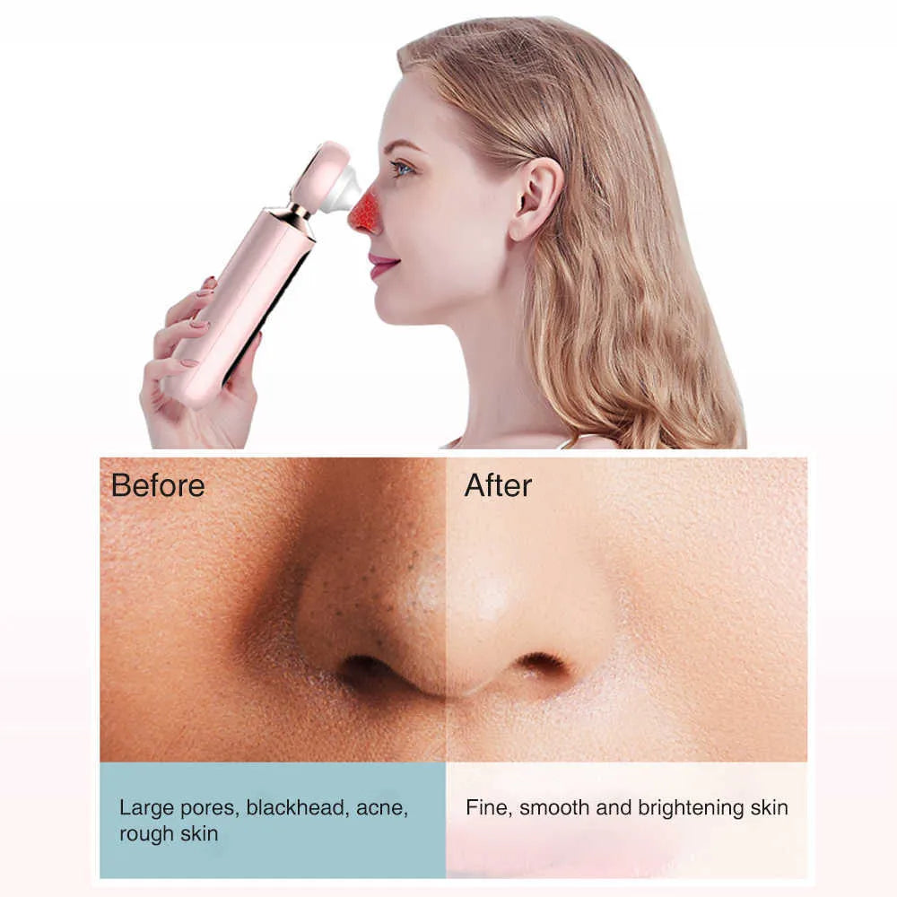 NoorAura™ Blackhead Suction Machine