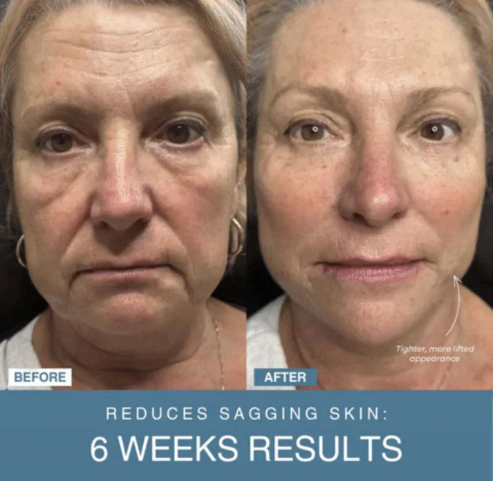 NoorAura™ 7-in-1 LED Anti-Aging/Wrinkle Apparatus