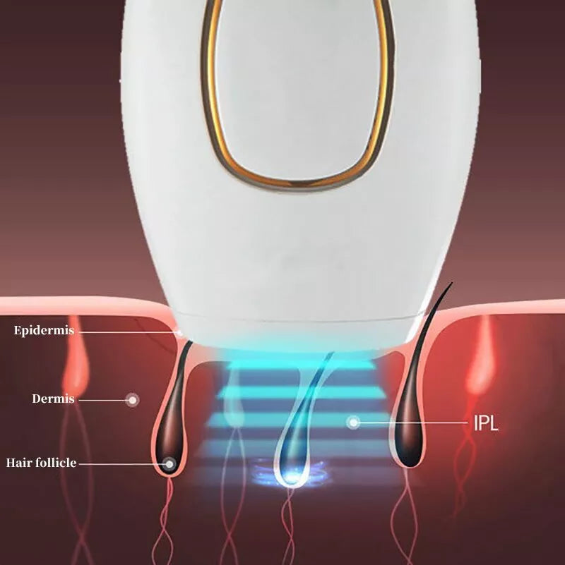 NoorAura™ IPL Laser Hair Removal – جهاز إزالة الشعر بالليزر IPL